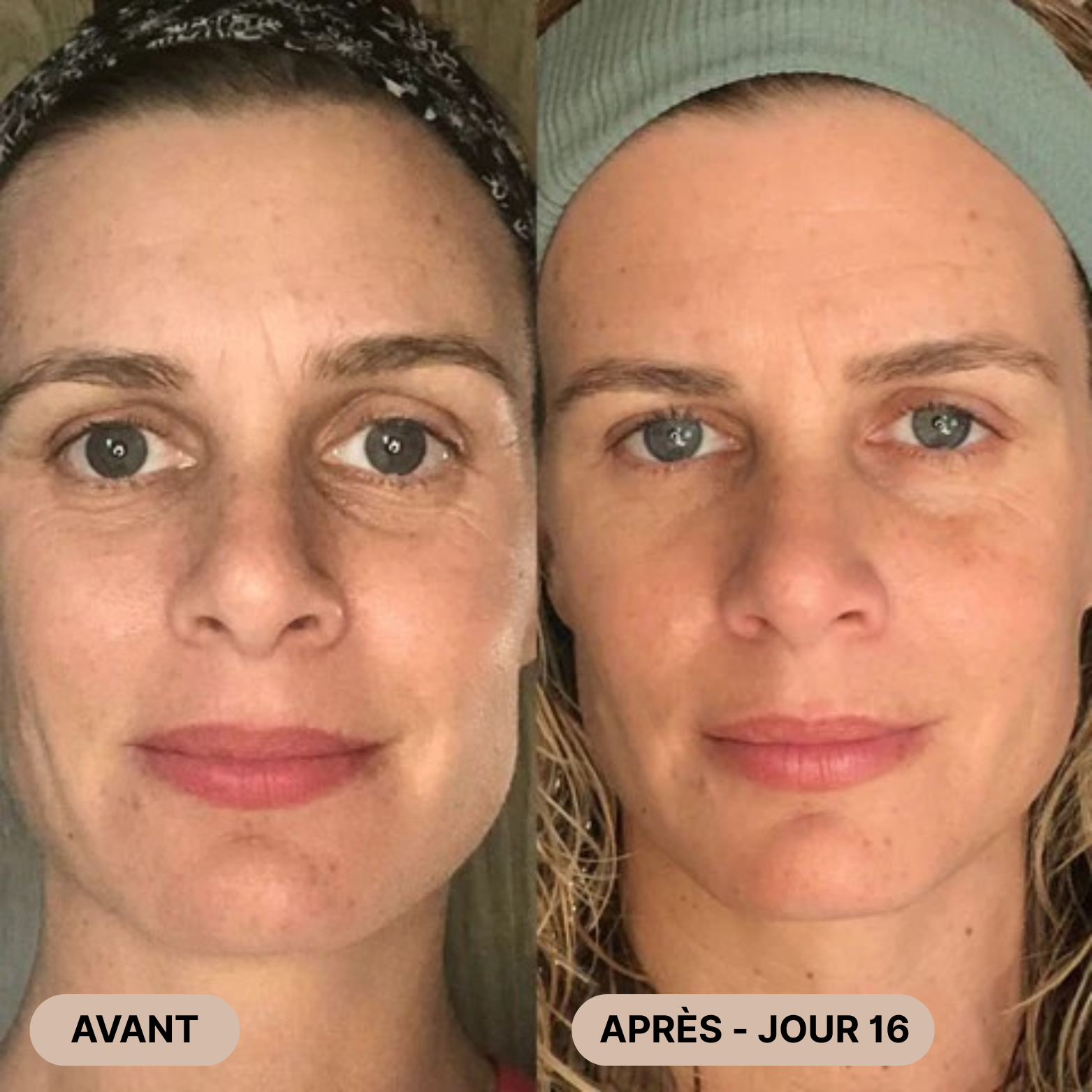 FaceLift Pro™