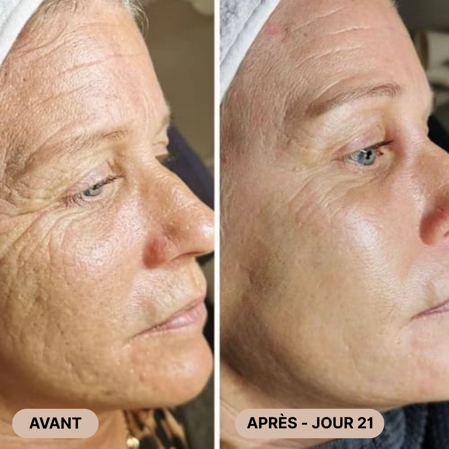 FaceLift Pro™